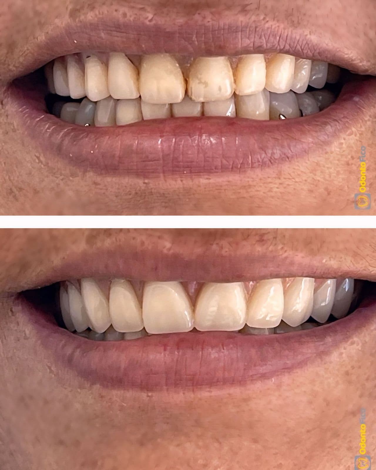 OdontoFico - Dentista em São José dos Campos