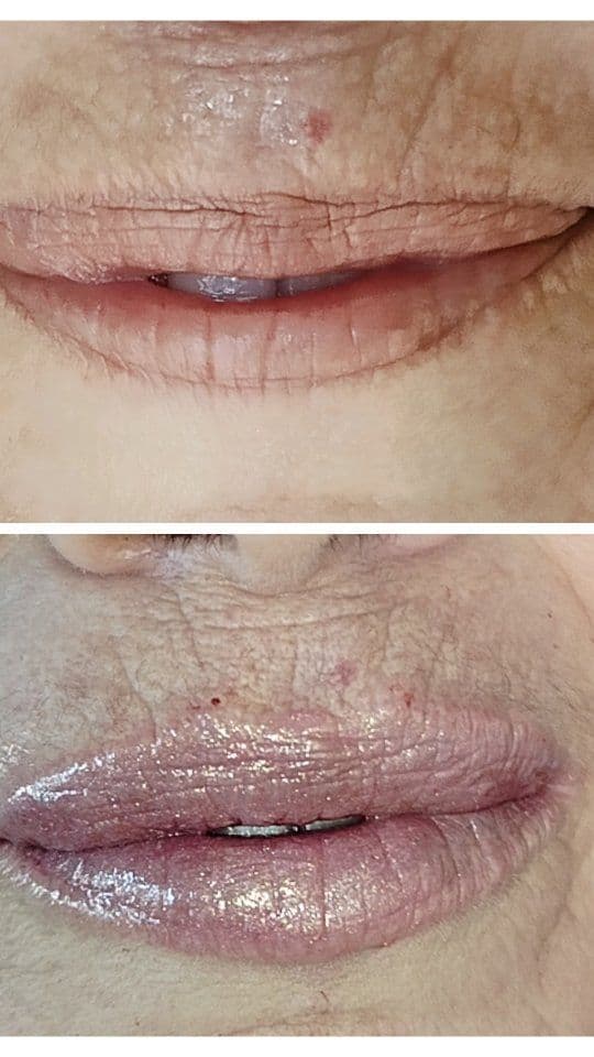 Dra Viviane Dias Faustino/ Especialista em Harmonização facial e corporal / Botox / Rejuvenescimento